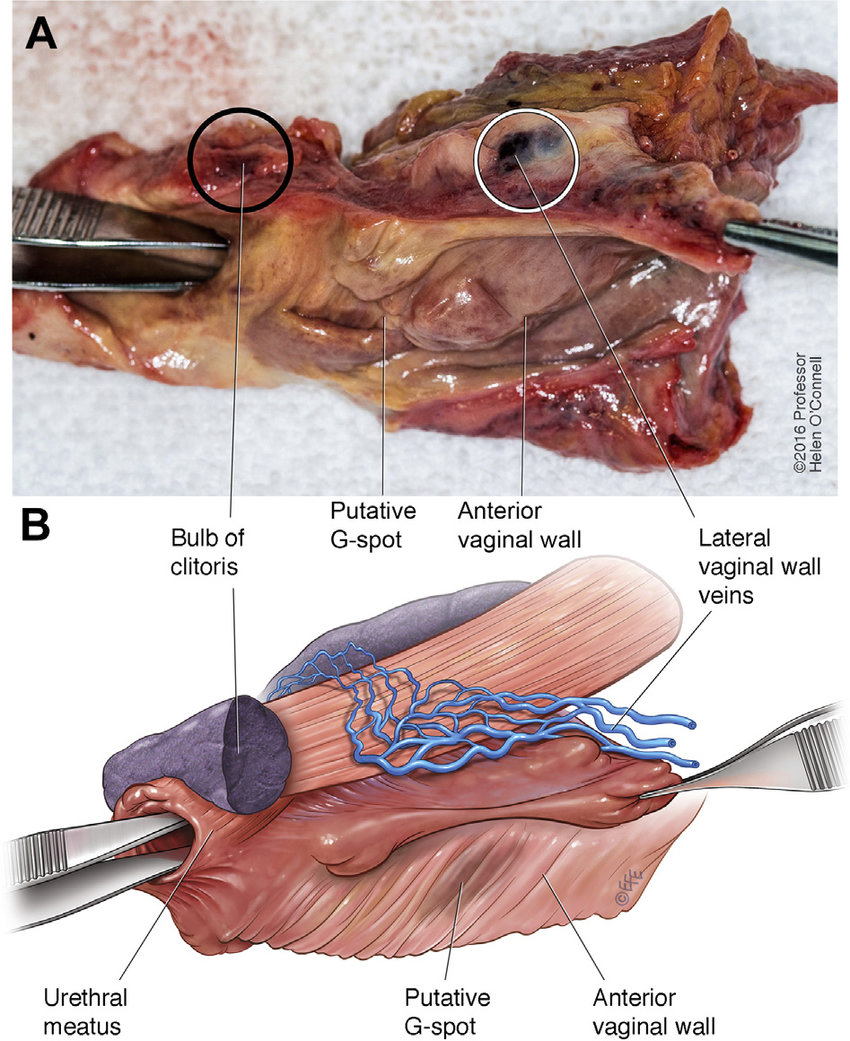 G Spot Diagram Panel A Shows A Photograph Of The Anterior Vaginal Wall And Urethra