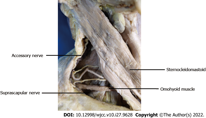 Supraclavicular Nerve Cadaver