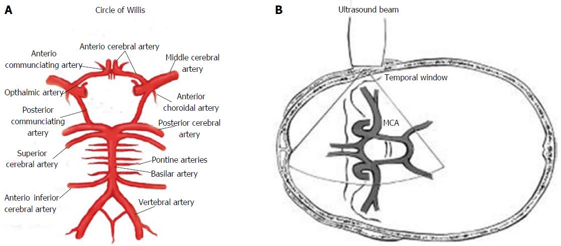 Middle Cerebral Artery Ultrasound