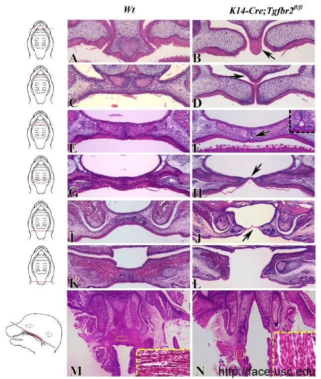 Hard Palate Histology