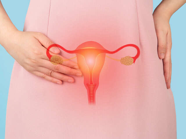 Ovarian Cyst: What Every Indian Woman Should Know About This Silent Visitor