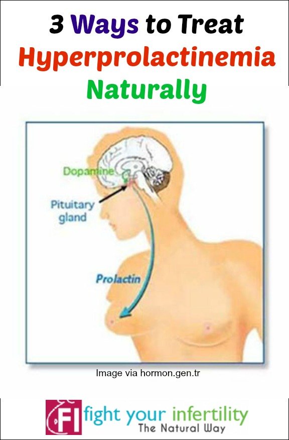 3 Ways to Treat Hyperprolactinemia Naturally