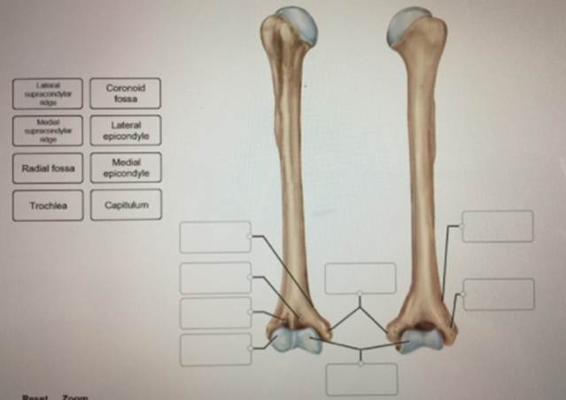 (Get Answer) - Correctly label the anatomical features of the humerus ...