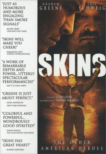 Skins poster