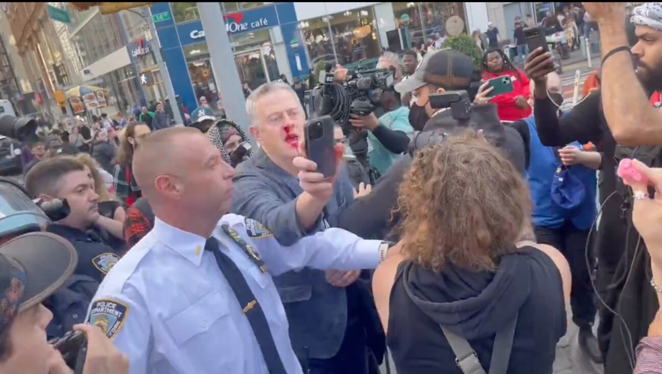 Todd Richman emerges with a bloodied nose after he was beset by protesters at Union Square, New York, Oct. 7, 2024. (X/Screenshot)