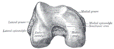 orthoLegFemurCondylesGrayBB246.gif