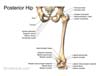 orthoPosteriorBoneHip.jpg