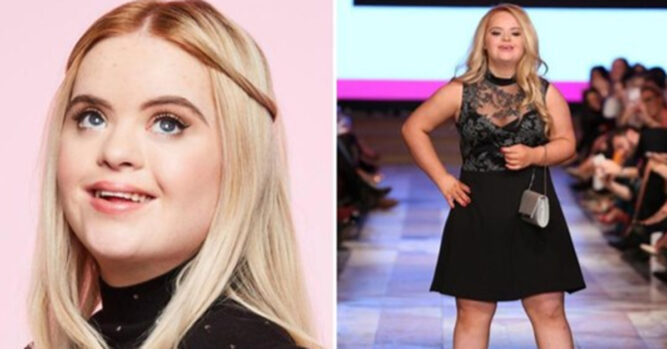 Beautiful Model With Down Syndrome Is The New Face Of ...