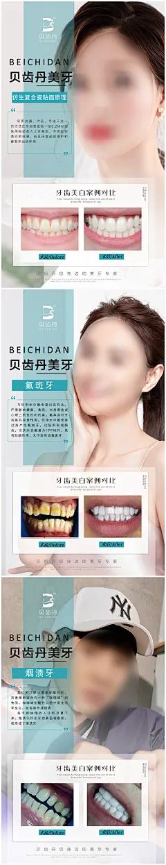 美牙口腔海报-志设网-zs9.com