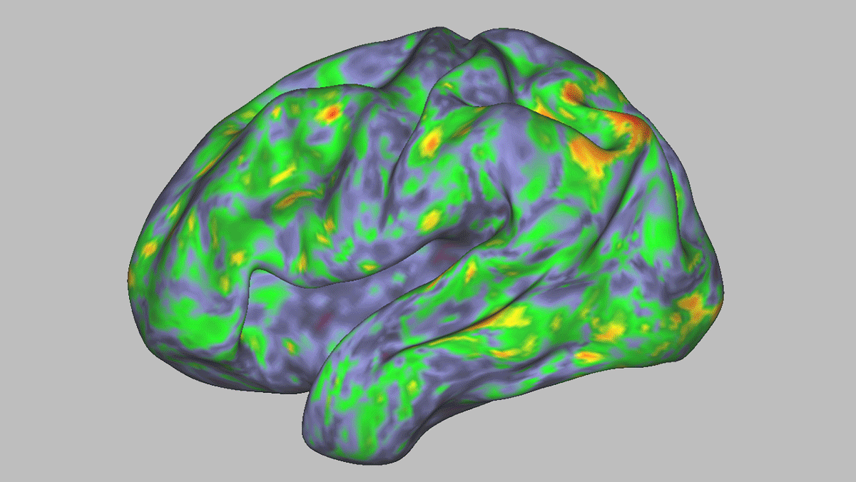 A map of brain activity.