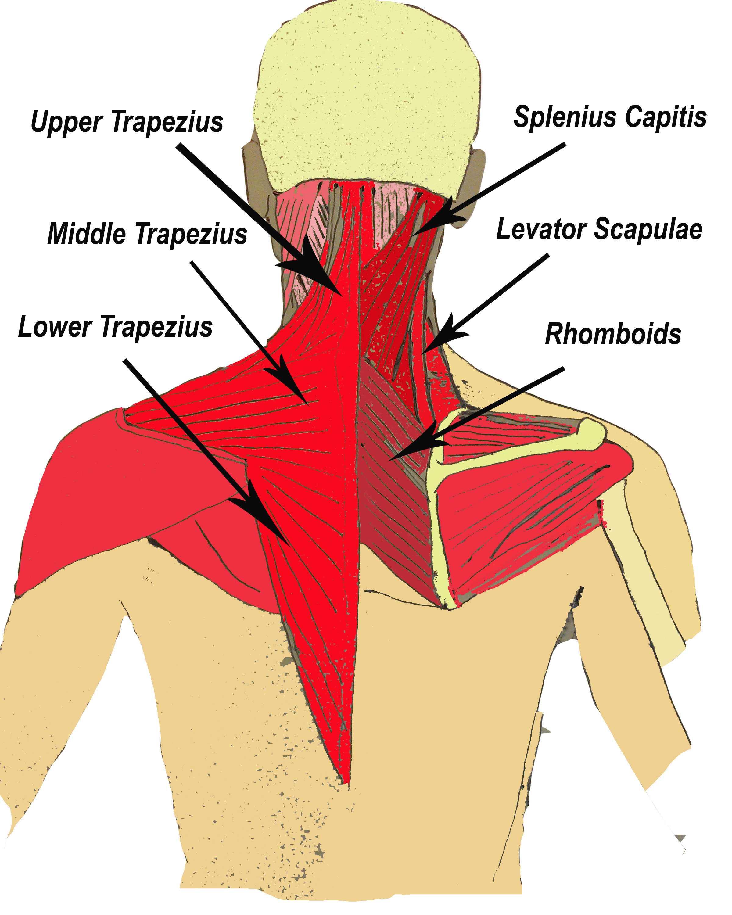 Levator Scapulae Trigger Points