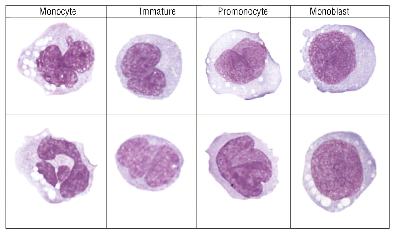 Difference Between Monocytes And Lymphocytes