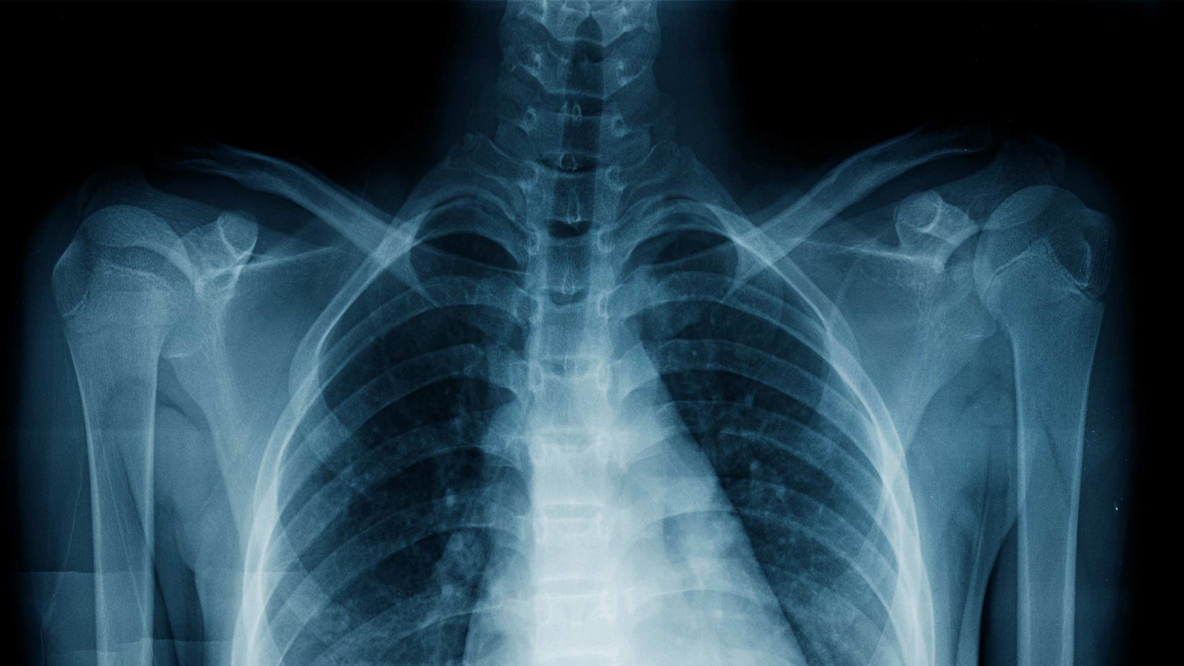 Are X-Rays Harmful? Why Scientists Cannot Say The Human, 52% OFF