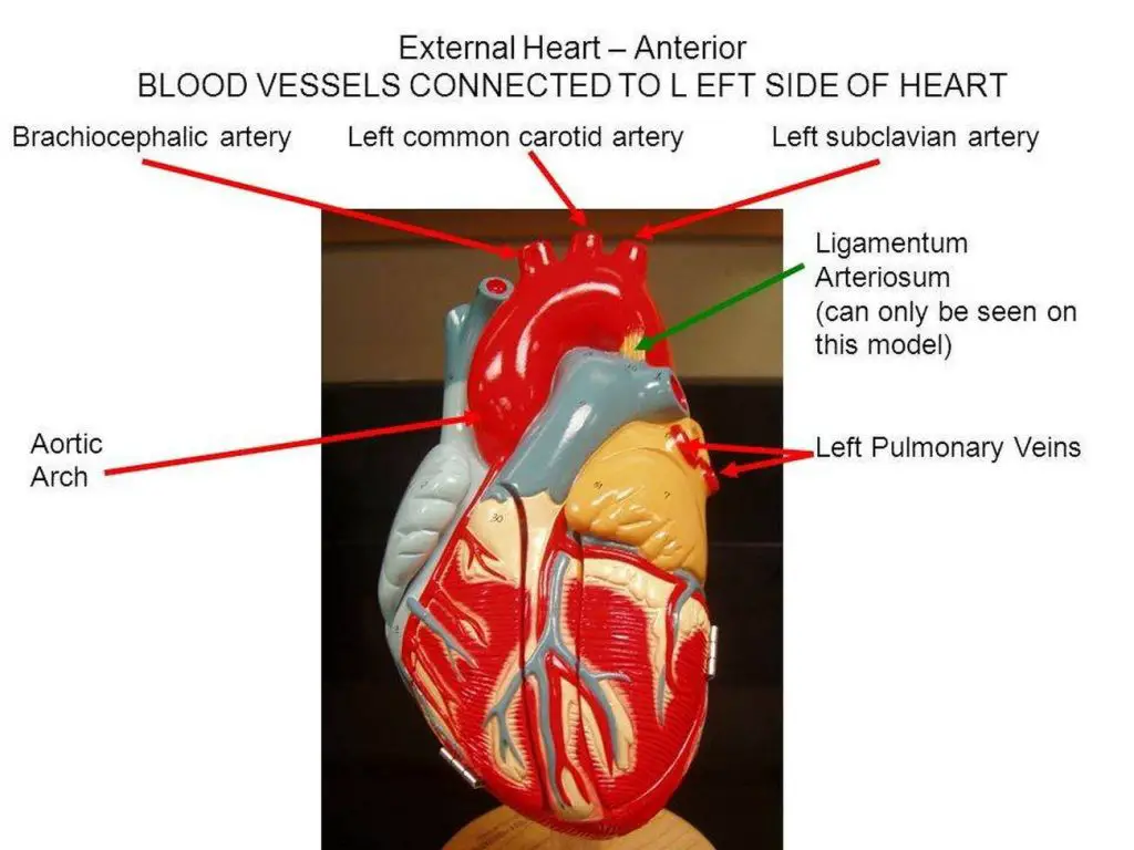 Pictures Of Brachiocephalic Artery