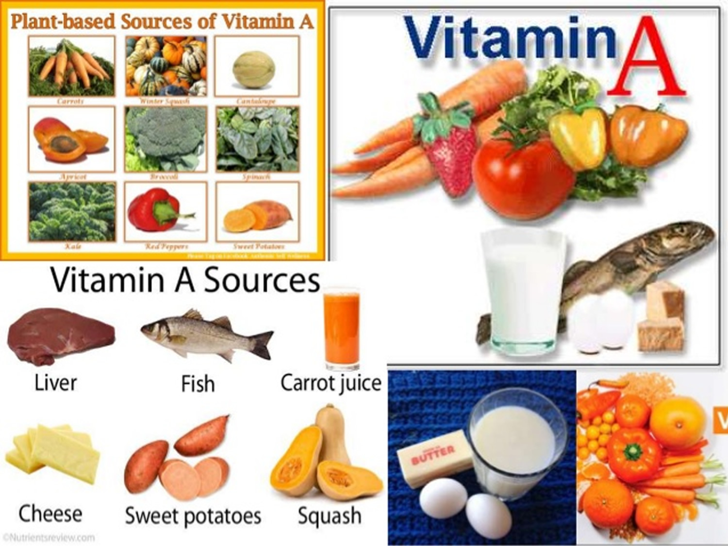 sources of vitamin A