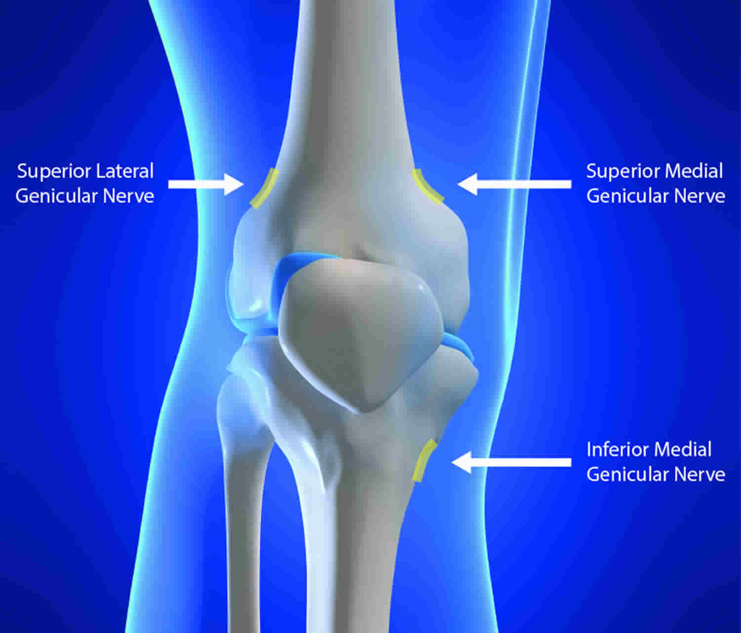 Genicular nerve block