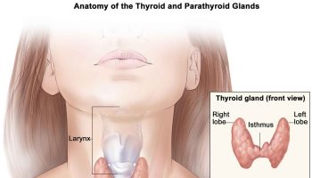 Hashimoto’s disease