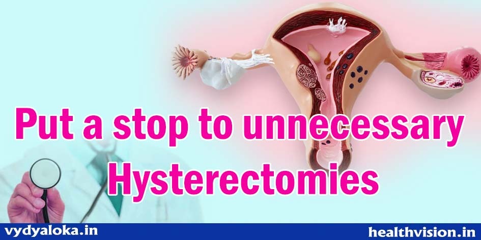 Hysterectomy should be the last resort for a woman - Health Vision