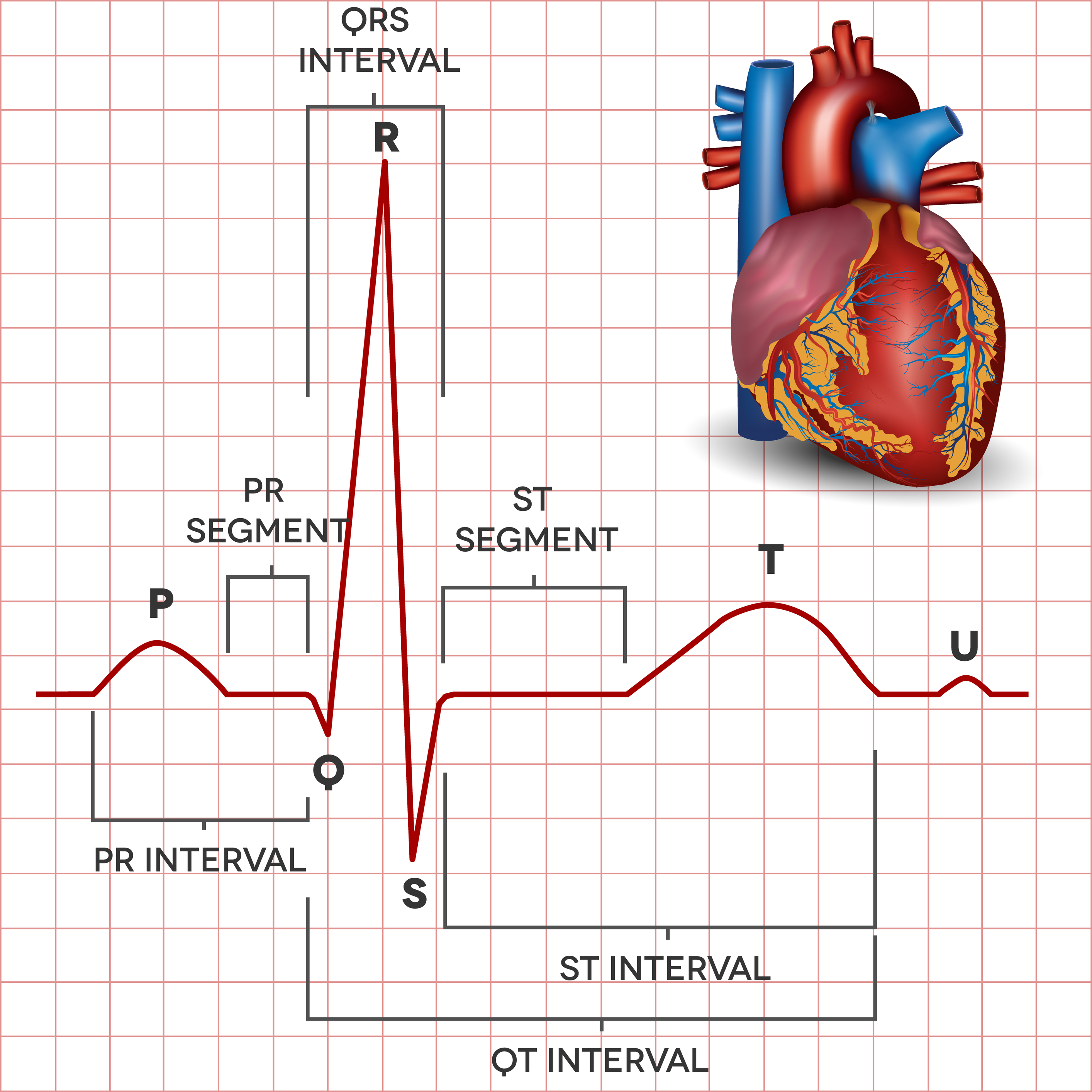 Electrocardiogramme Ecg Definition Fonctionnement Et Risques De Images ...