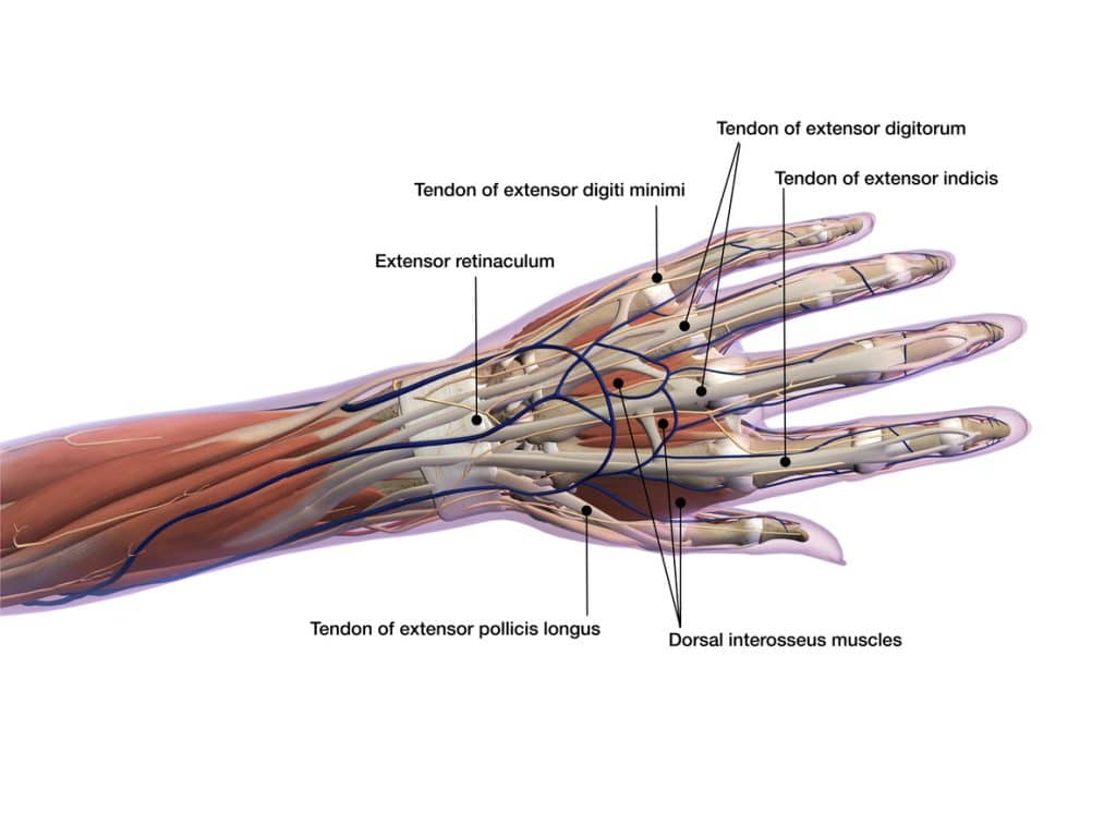 Common Flexor Tendon Tear