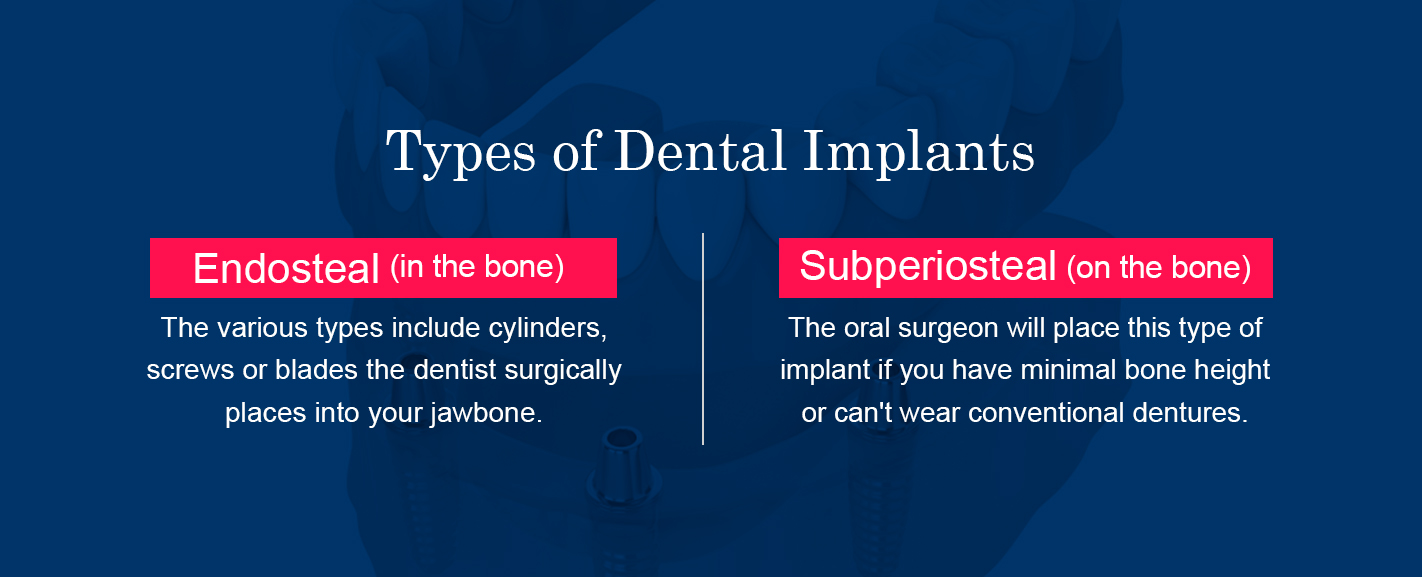 Types of dental implants