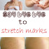 Say bye bye to stretch marks