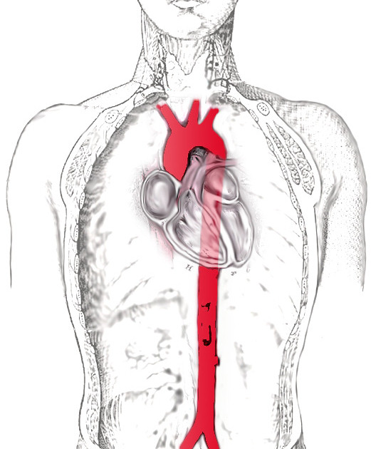 Aorta – howMed