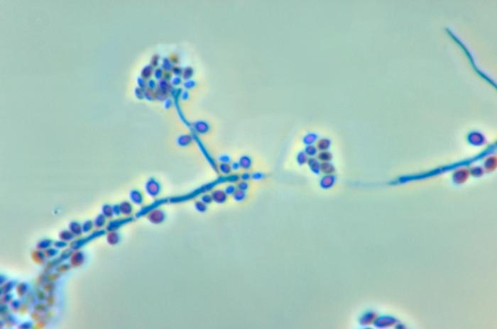 Conidiophores and conidia of Sporothrix schenckii