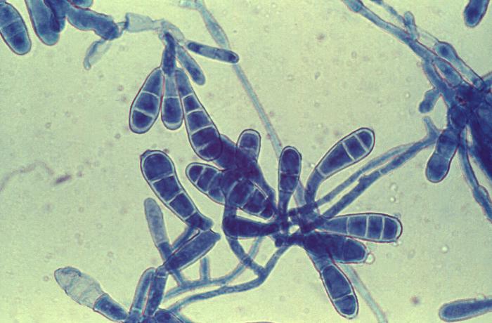 Macroconidia of Epidermophyton floccosum and filamentous hyphae