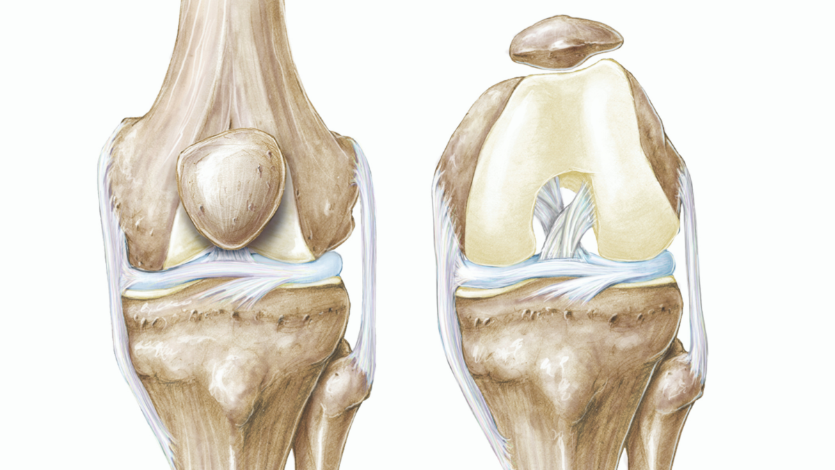 ACL Reconstruction