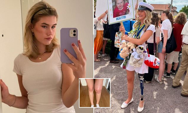 Student, 19, forced to have leg amputated after mistaking cancer for joint pain - here's