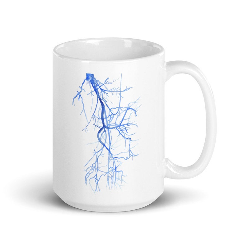 Radiology Mug, Vascular Surgery Gift, Radiologist Mug, Vascular Nurse ...