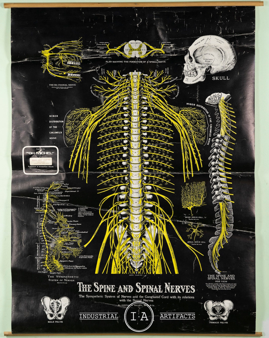 Vintage Spinal Nerve Chiropractic Chart - Etsy