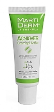 Veido gelis Martiderm Acniover Cremigel Activo