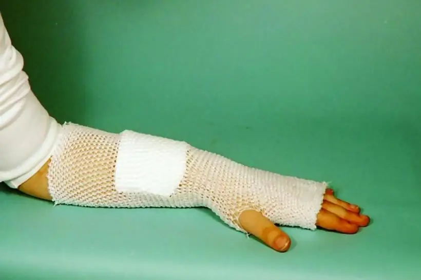 Elastic tubular mesh bandage