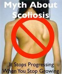 Adults with scoliosis over 30° have a 68% risk of further progression