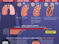 53 Best Medical Lungs Respiratory (Health) images | Health, Health ...