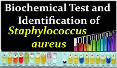 a sign that says, biochemic test and identification of staphylococus aveus