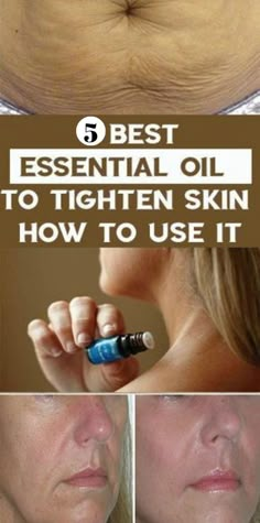 Tighten Skin, Essential Oils For Skin, Young Living Oils, Best Essential Oils, Loose Skin, Essential Oil Uses, Oil Uses, Sagging Skin