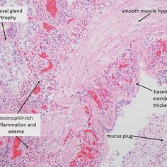 Histology - Islet of Langerhans with alpha and beta cells | Histology ...