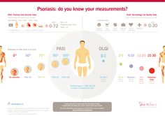 Find out how psoriasis severity and quality of life are measured, and how the two are linked, in our new infographic www.skintolivein.com Skin Diseases And Disorders, Disease Infographic, Public Health Infographics, Life Quality, Health Issues, Dermatology, Self Talk, Skin Conditions, Medical