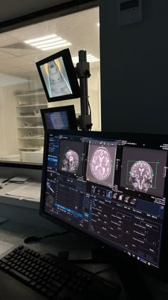 Radiology aesthetic, brain MRI Radiology Student, Medical School Motivation, Medicine Student, Biomedical Engineering, Career Vision Board, Medical School Inspiration