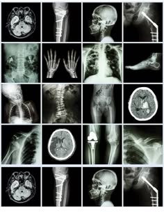 an x - ray shows different types of bones and their functions in the human body