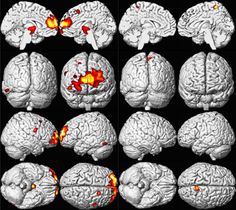 Lead (Pb) Toxicity: What Are the Physiologic Effects of Lead Exposure? | ATSDR - Environmental Medicine  Environmental Health Education - CSEM Brain Scan, Out Of Body, Developmental Disabilities, Energy Healer, Environmental Health, City Council, Neuroscience, Health Education, Scientists