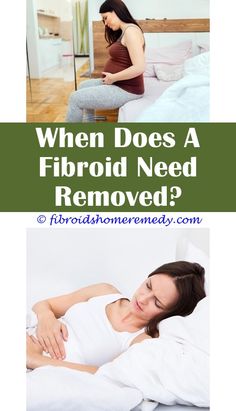 Icd 10 Code For Fibroids