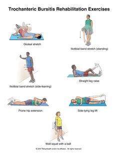 Trochanteric Bursitis Rehabilitation Exercises Patellofemoral Pain Syndrome Exercises, Runners Knee Exercises, Greater Trochanteric Pain Syndrome, Greater Trochanter, Body Pain Relief, Physical Therapy Exercises