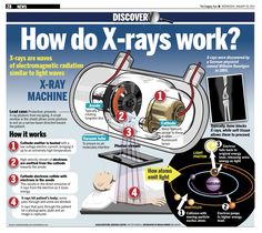 the diagram shows how x - rays work and what they can do to fix them