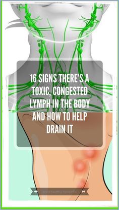 16 Signs There�s A Toxic, Congested Lymph In The Body And How To Help Drain It Cramps Relief, Health Planner, Creating A Newsletter, Health Remedies, Body Skin, Easy Workouts, Body Skin Care, Hair Removal, The Body