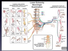 Nerve Anatomy, Physical Therapy Student, Physical Therapy Assistant, Bolesti Chrbta, Spine Health, Lower Limb, Medical School Essentials