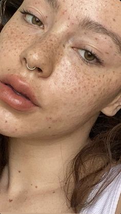 a woman with freckles on her face looking at the camera